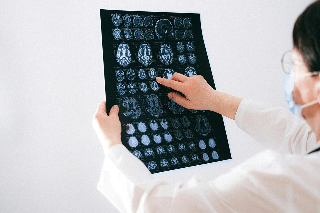 Early signs that your brain is failing you