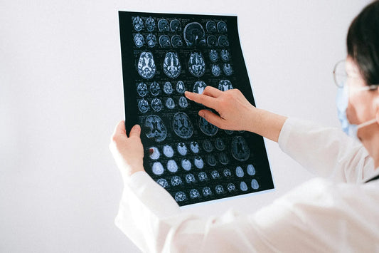 Early signs that your brain is failing you